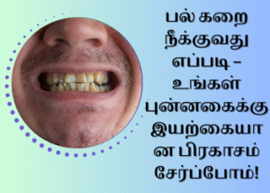 பல் கறை நீக்குவது எப்படி
