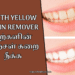 Teeth Yellow Stain Remover | பற்களின் மஞ்சள் கறை நீக்க