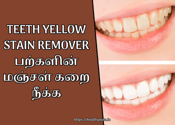 Teeth Yellow Stain Remover | பற்களின் மஞ்சள் கறை நீக்க
