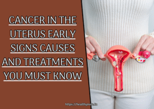 Cancer in the Uterus Early Signs Causes and Treatments You Must Know