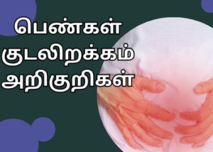 பெண்கள் குடலிறக்கம் அறிகுறிகள்