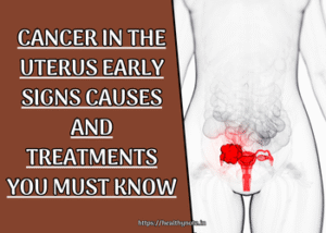Cancer in the Uterus Early Signs Causes and Treatments You Must Know