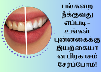 பல் கறை நீக்குவது எப்படி – உங்கள் புன்னகைக்கு இயற்கையான பிரகாசம் சேர்ப்போம்!