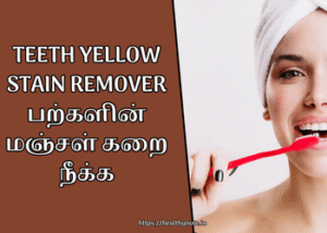 Teeth Yellow Stain Remover | பற்களின் மஞ்சள் கறை நீக்க