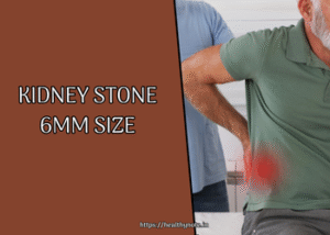 Kidney Stone 6mm Size