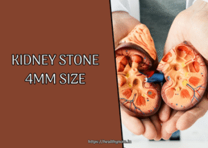 Kidney Stone 4mm Size