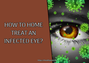 How to Home Treat an Infected Eye?