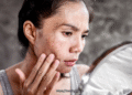 Cancer White Spots on Skin