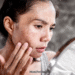 Cancer White Spots on Skin