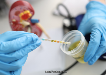 Urine Infection Yellow Discharge