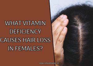 What Vitamin Deficiency Causes Hair Loss in Females?