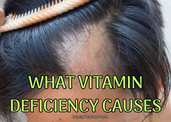 What Vitamin Deficiency Causes Hair Loss in Females?