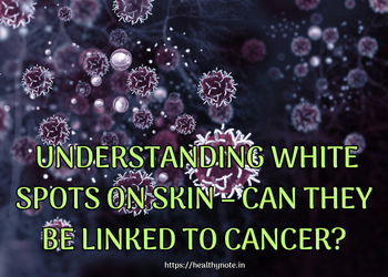 Understanding White Spots on Skin – Can They Be Linked to Cancer
