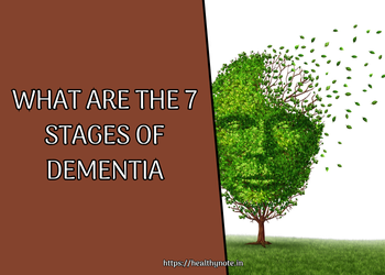 What are the 7 stages of dementia