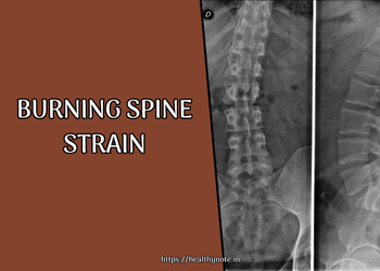 Burning Spine Strain